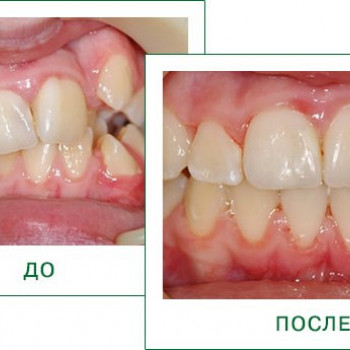 Дентавр, Perm Фото - 5