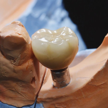  La Denta dental & implant clinic, Perm Фото - 2