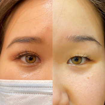 Callisto Beauty Clinic, Астана Фото - 5