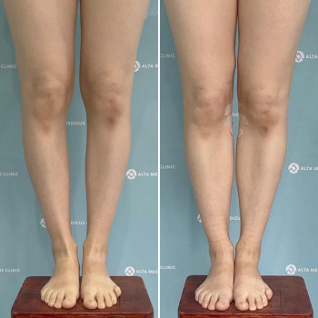 Alta medicus clinic, Astana Фото - 6