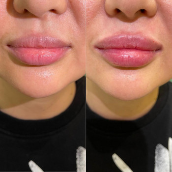 Amelie, Astana Фото - 5