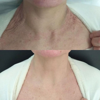 Gen87, Astana Фото - 5