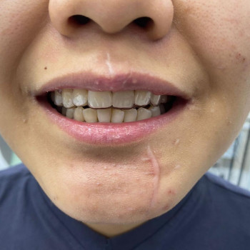 Modern dental clinic Aksholakovnoi, Астана Фото - 5