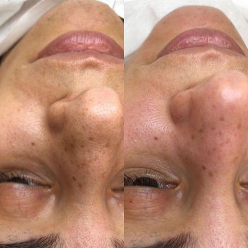 Нилюфар Раева, Астана Фото - 5