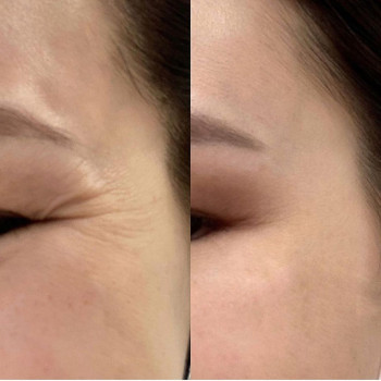 Молдир Ниетхановна, Astana Фото - 5