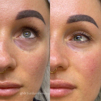 Салтанат Кушчубековна Турдумбекова, Астана Фото - 5