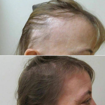 Жупар Ергалымкызы Хабидолла, Astana Фото - 5