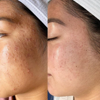 Beauty Access, Астана Фото - 5