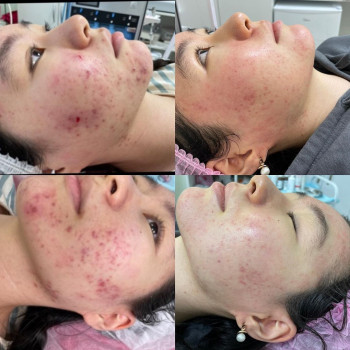 Шынар Жұманбай, Astana Фото - 5