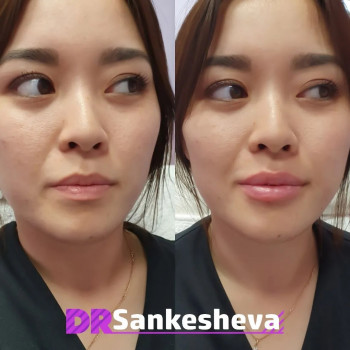 Маржана Санкешева, Astana Фото - 5