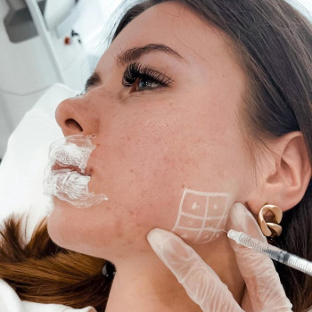 Алма Шамшулиева, Astana Фото - 5