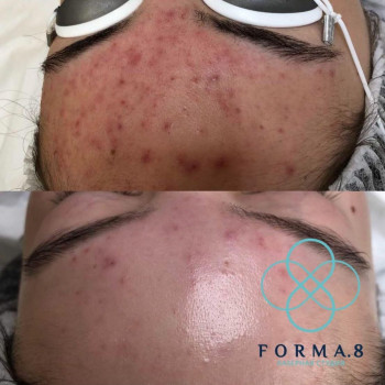 Forma 8, Астана Фото - 5