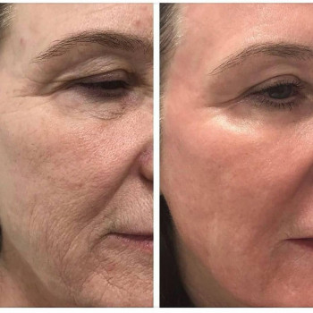 Екатерина Изотова, Астана Фото - 5