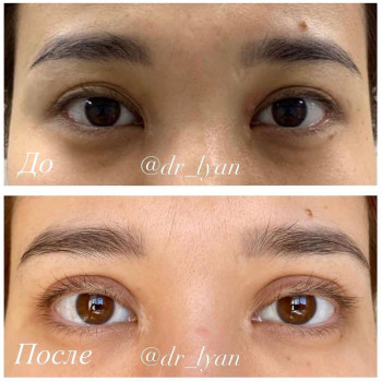 Лян Чундун, Astana Фото - 5