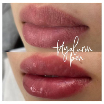 Светлана Бондаренко, Vladivostok Фото - 5