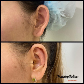 Ернат Аманович Бакытбеков, Астана Фото - 5