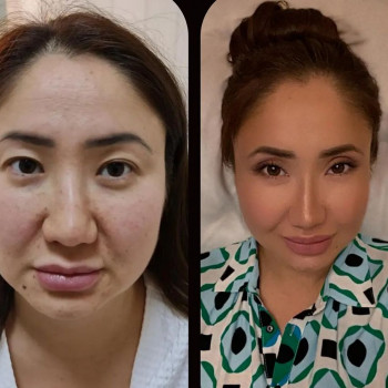 Куаныш Сексенбаев, Астана Фото - 5