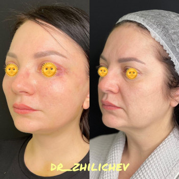 Дмитрий Жиличев, Астана Фото - 5