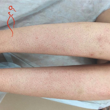 Айгерим , Astana Фото - 5