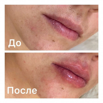 Мадина Ералиевна Сматова, Astana Фото - 5