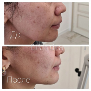 Индира , Astana Фото - 5