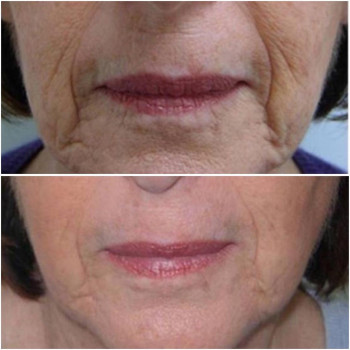 Евгения Юрьевна Пак, Astana Фото - 5