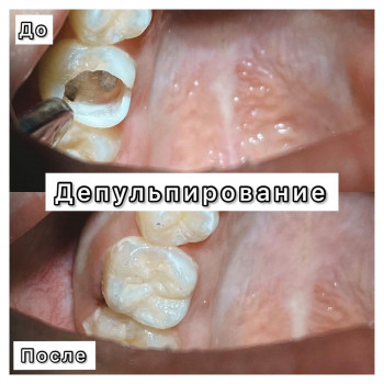 Дархан Кайратович Маткулов, Астана Фото - 5