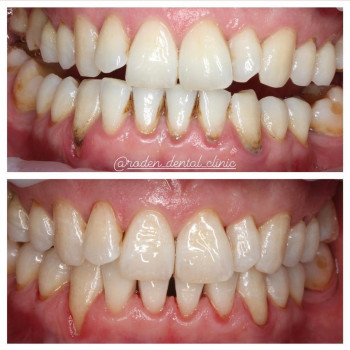 Roden Dental Clinic, Астана Фото - 5