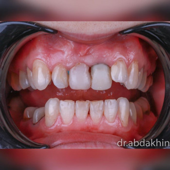 Абдахин Еркебулан Серикович, Астана Фото - 5