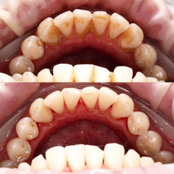 Улжан Сакеновна Тлеубек, Astana Фото - 5