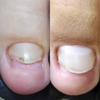 Анна Торубара, Астана Фото - 5