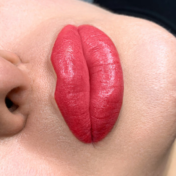 Для любителей поярче. В зажившем виде, такой насыщенности не