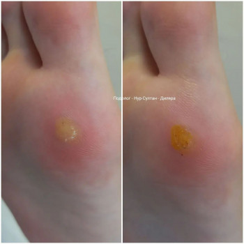 Диляра , Astana Фото - 5