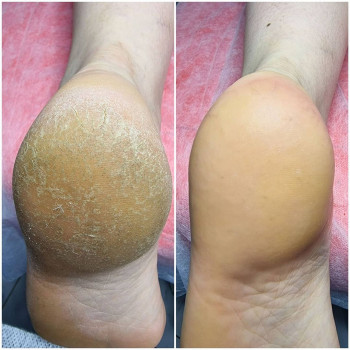 Гульсум Аймен, Astana Фото - 5