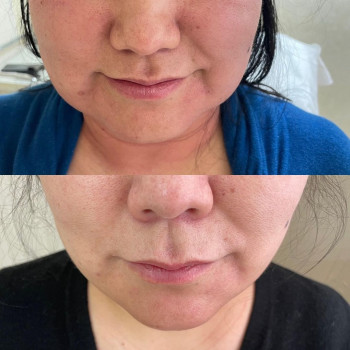 Эльмира Ахметжанова, Astana Фото - 5