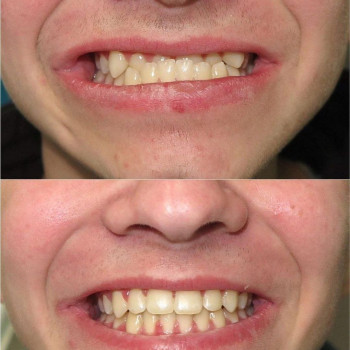 Жамиля Куралбековна Даулбаева, Almaty Фото - 5