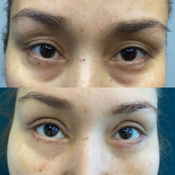 Ардак Есимович Каиров, Almaty Фото - 5