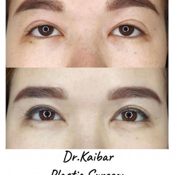 Кайбар Булатович Айтжанов, Almaty Фото - 5