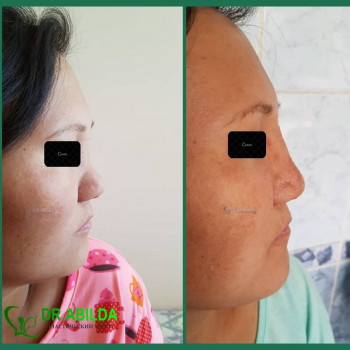 Нуржан Абилда Жандилдаевич, Almaty Фото - 5