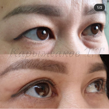 Талгат Тлекович Карымсаков, Алматы Фото - 5