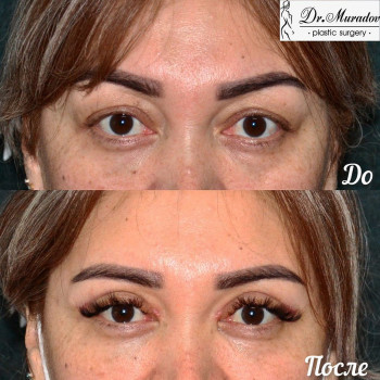 Мисмил Исламович Мурадов, Almaty Фото - 5