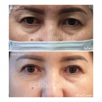 Айна Досан, Алматы Фото - 5