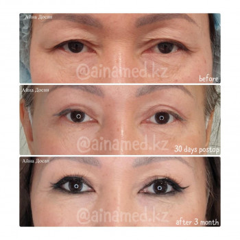 Айна Досан, Алматы Фото - 6