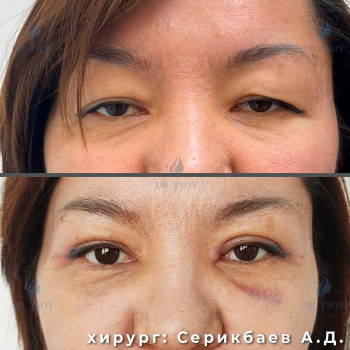 Анастасия Викторовна Цой, Алматы Фото - 5