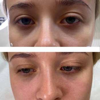 Индира Абдураимова, Шымкент Фото - 6