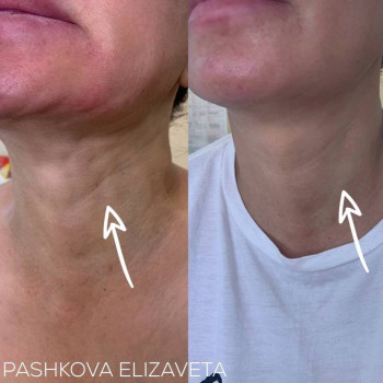 Елизавета Пашкова, Шымкент Фото - 5