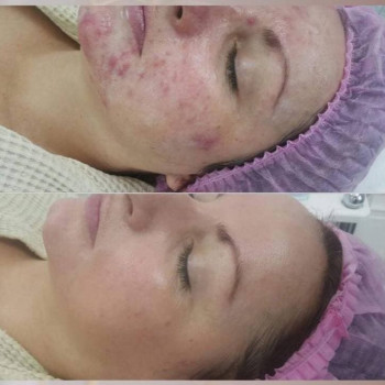 Гульфайзур Жуманбай, Shymkent Фото - 5