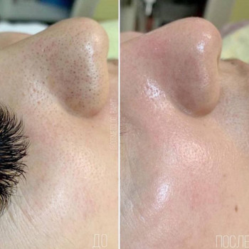 Сулейман Бахыт, Shymkent Фото - 5