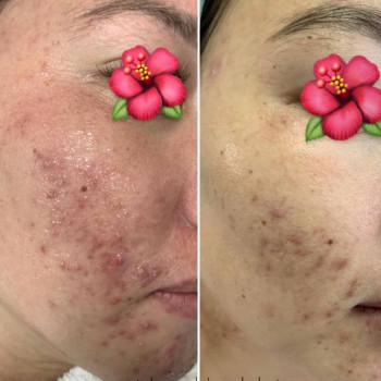 Сулейман Бахыт, Shymkent Фото - 6