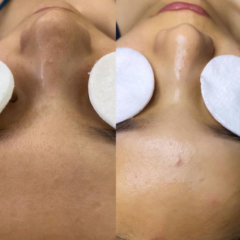 Севера Юнусовна, Shymkent Фото - 5